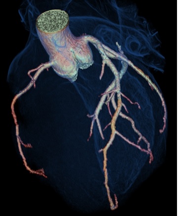 Herz-CT Gerät
